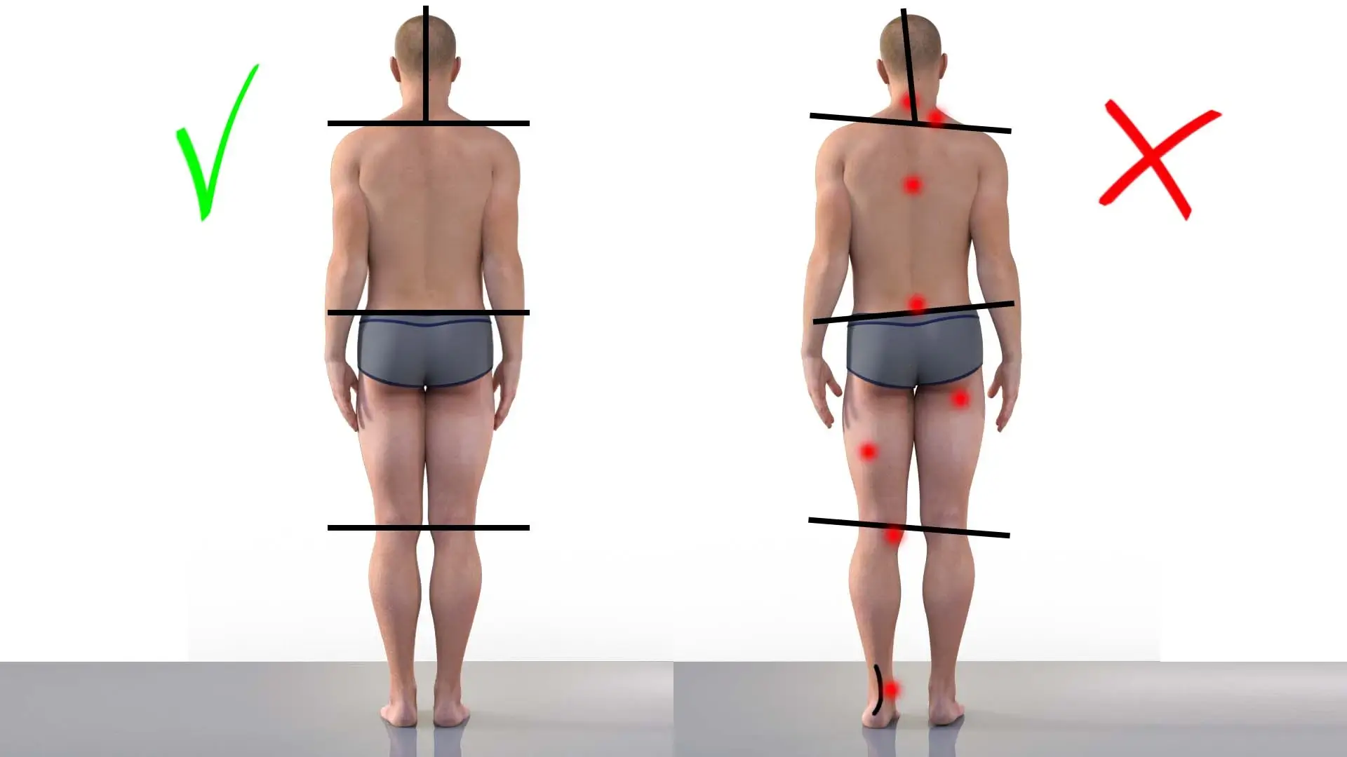 Valutazione Posturale