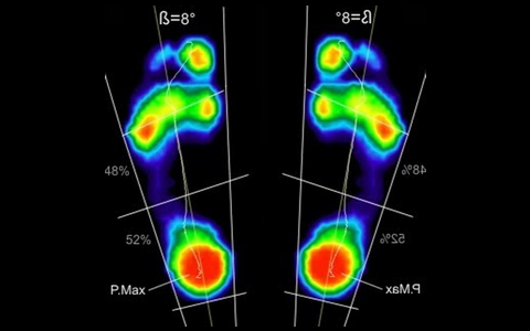Analisi Baropodometrica